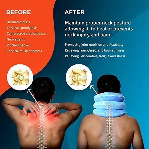 NeckFix Cervical Neck Traction Device – 12-17 Inch