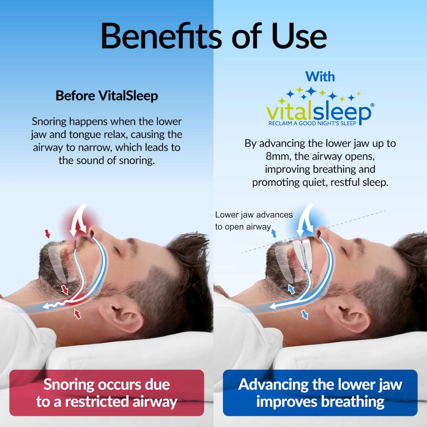 VitalSleep Anti-Snoring Mouthpiece, Comfortable & Adjustable Snore Guard, Quiets Snoring, USA Made, BPA Free & FDA Cleared Anti-Snore Device – Men’s Size