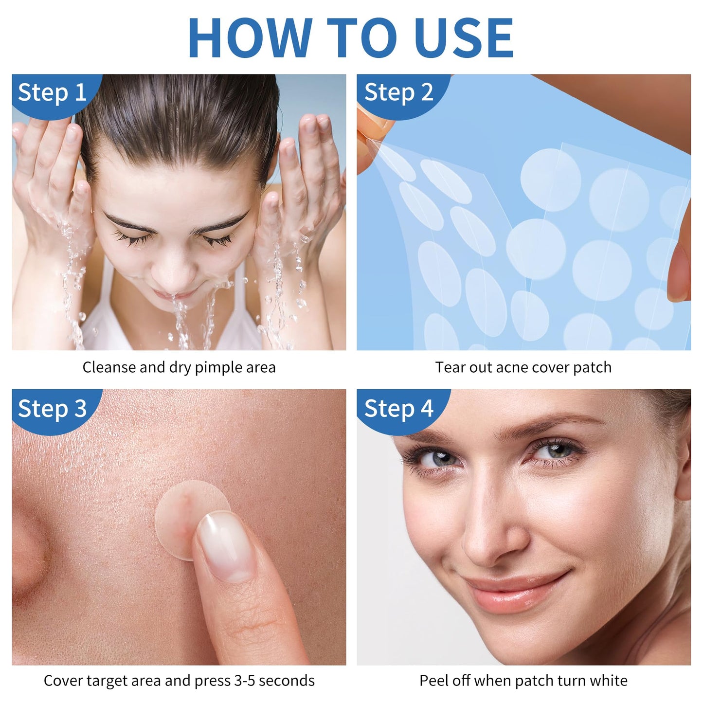 Pimple Patches for Face, 4 Size 300 Counts Acne Patches, Hydrocolloid Patches for Covering Zits and Blemishes, Spot Stickers with Salicylic Acid, Tea Tree Oil & Calendula Oil